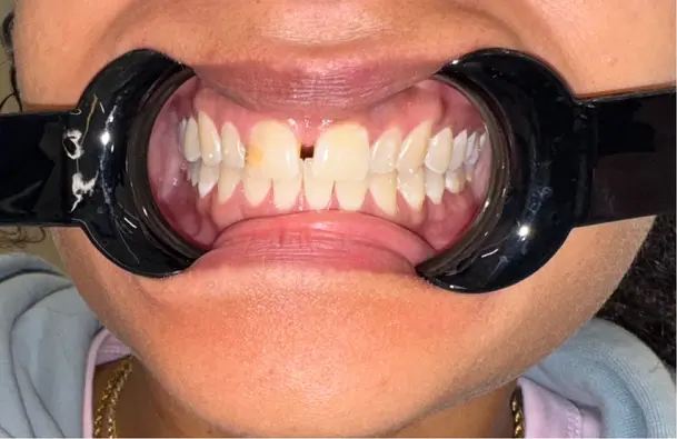 Pristine-Dental-Group-30