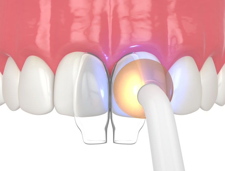 composite process