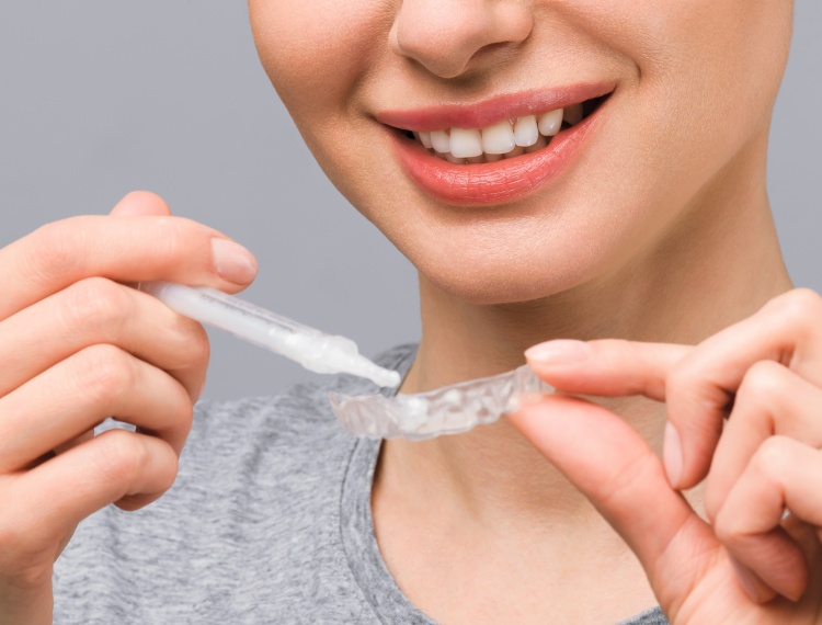 teeth whitening tray